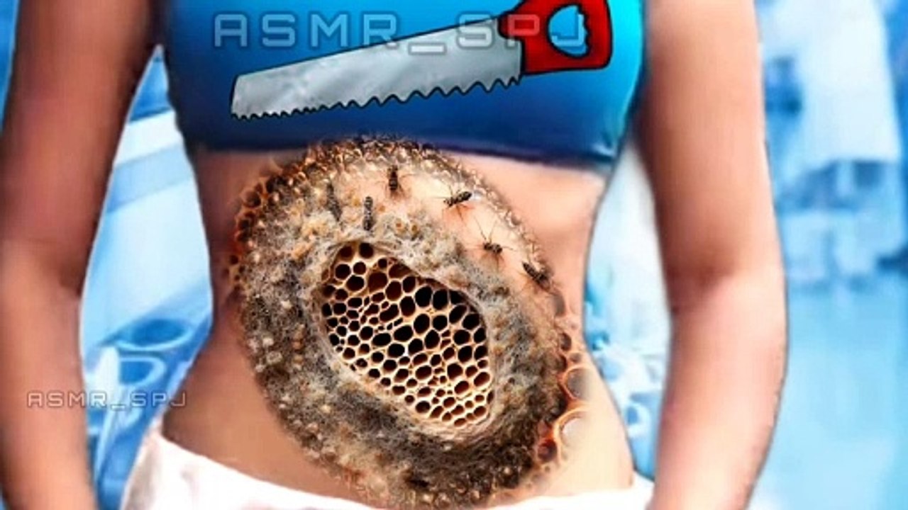 ASMR Maggots Removal Animation" | #asmr