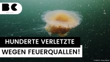 An Ostsee-Stränden: Hunderte Verletzte durch Feuerquallen