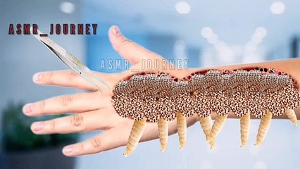 "Hand ASMR Animation| Maggots and Dogticks Removal Treatment"