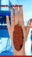 Asmr hand injury treatment Animation #satisfying #sleepsounds