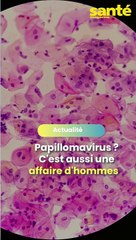 Papillomavirus : c'est aussi une affaire d'hommes !