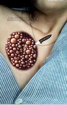 Chest cleaning treatment Animation #animation #makeup #2danimation