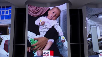 الأمم المتحدة تدعو لهدنة إنسانية في غزة لبدء حملة تطعيم ضد شلل الأطفال