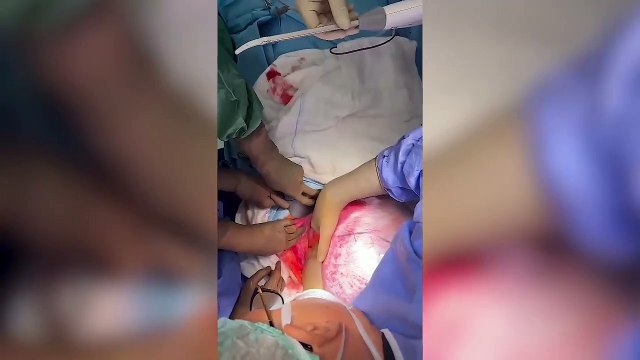Kilo alıyorum sandı! Karnından çıkan şeyi görenler gözlerine inanamadı