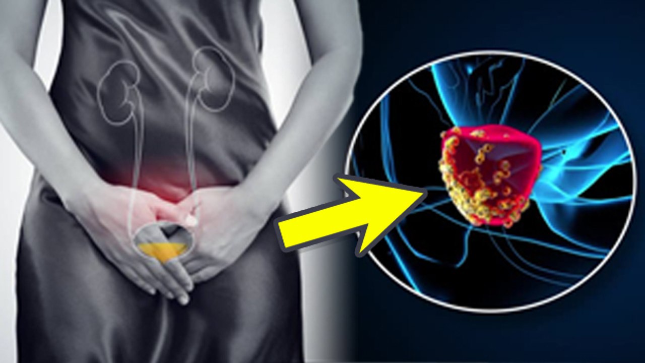 Can Recurrent UTI Be a Sign of Cancer, What Cancer Causes Recurrent UTI | Boldsky