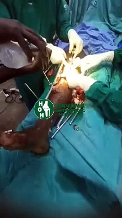 Our staff carrying out an operation