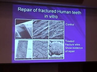 Part 2 Riparazione base dentale tramite ultrasuoni