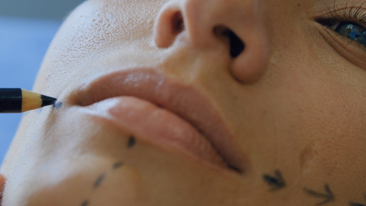 ‘Surgical Tourism’: What are the risks of going abroad for cosmetic surgery?