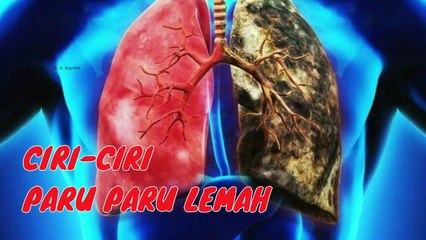 Tanda-tanda Ini Menunjukkan Paru-paru kita melemah yang harus kita waspadai