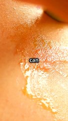 Aloe Vera Magic_ Nature's Miracle Healer