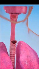 Laryngectomy Procedure Animation लेरिन्जेक्टोमी प्रक्रिया एनीमेश गले के कैंसर जागरूकता वीडियो جراحة سرطان الحنجرة