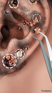 How To Clean Infected Hole EAR Piercing | Ear Cleaning Therapy asmr #earings #animation #treatment #dailymotion
