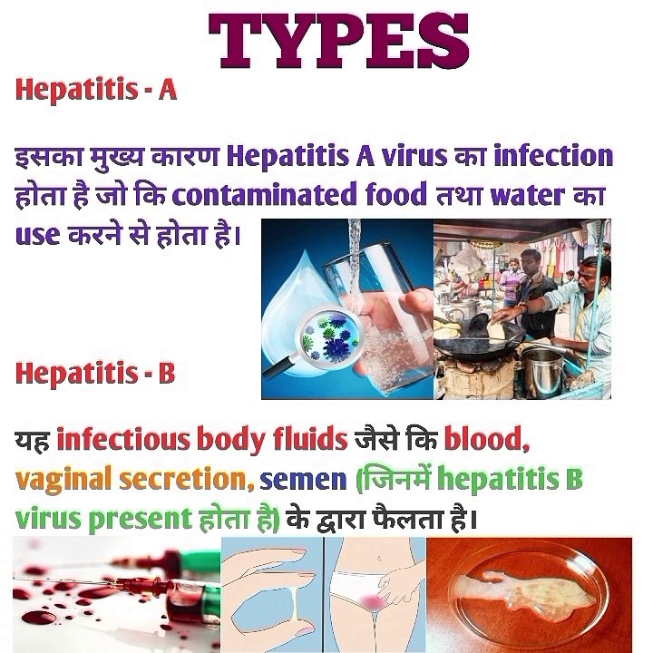 ✅Hepatitis A,B,C,D,E | Causes | Route of Spread |  Symptoms |  Complications |  Vaccination |  Treatment