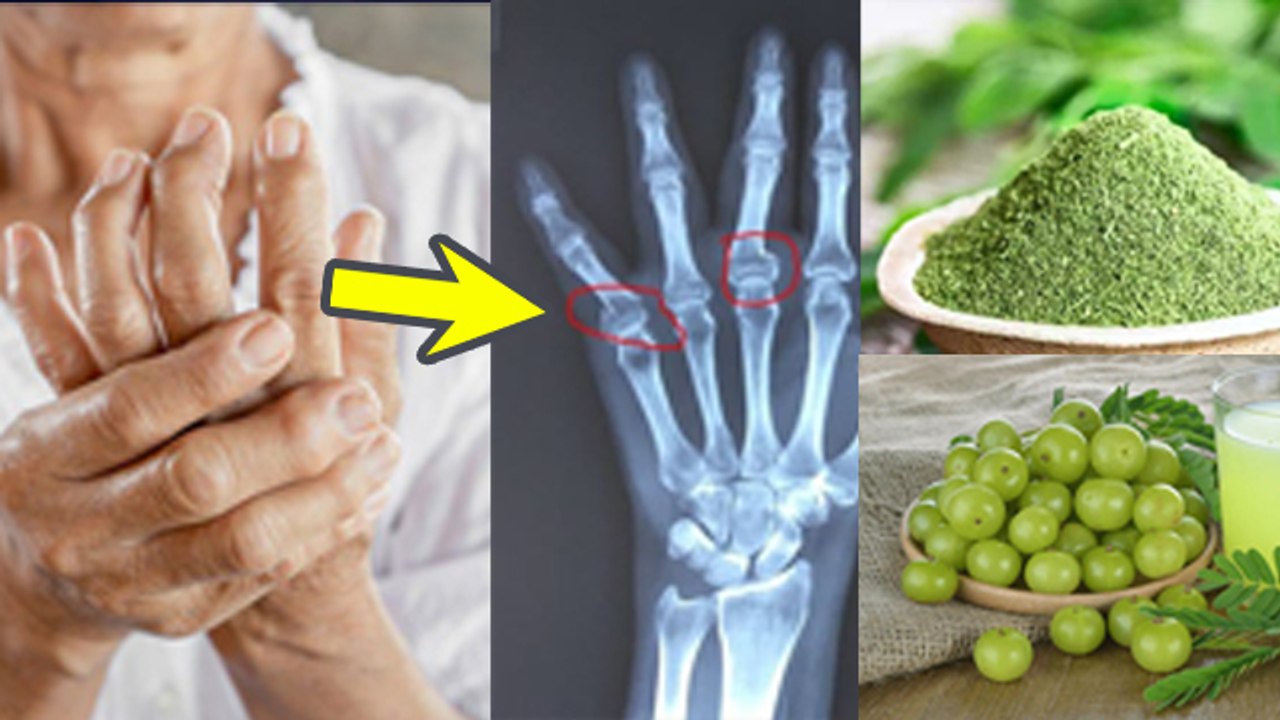 Moringa and Amla Juice Benefits in High Uric Acid|हाई यूरिक एसिड में मोरिंगा आमला जूस पीने के फायदे