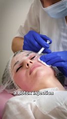 How Botox Actually Works  #reels #surgery #PlasticSurgery #science #sciencefiction #factsyoudidntknow #Aquarius