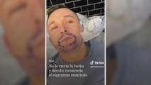 No le crecía la barba y se la tatúa: el resultado es para verlo en bucle