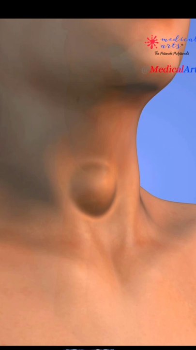 The 30-Minute Thyroid Relief Procedure