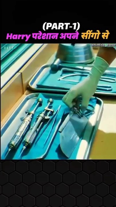 Horn on the head of Boy   #Amazing #viralpost #2024viralvideo #viralreelsシ #2024readingchallenge #foryoupageシforyou #2024trends #foryoupagereels