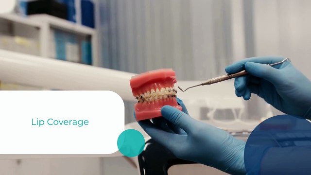 6 Key Tips for Optimizing Your Smile Simulation App