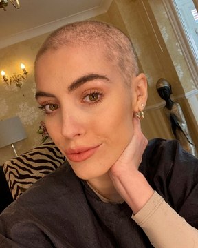 I used to be an 'it girl' - then an avocado-sized tumour ruined my life