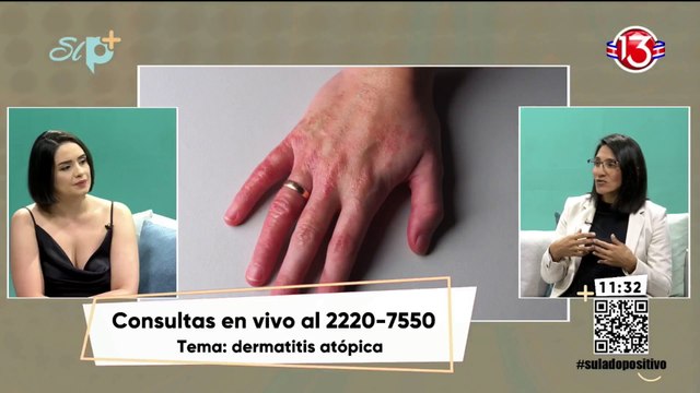 Entrevista - Dermatitis atópica