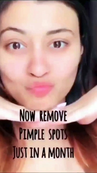 ✨ Remove Pimple Spots in Just 30 Days!  Clear Skin Secrets Revealed #AcneTreatment