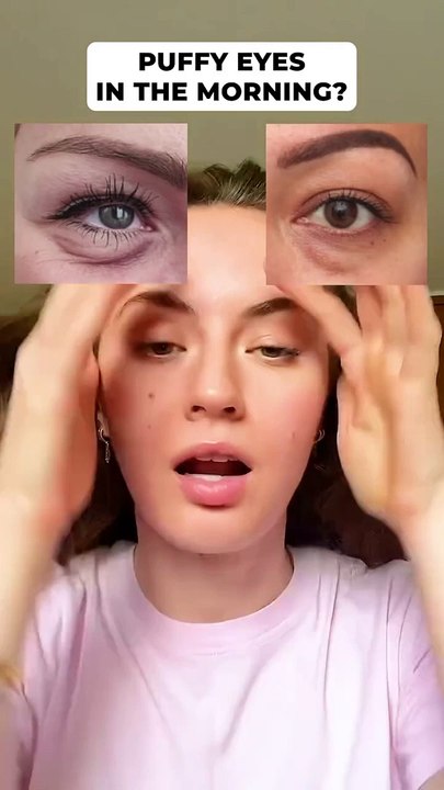  Banish Puffy Eyes in the Morning! ✨ Quick Fixes for a Fresh, Bright Look #SkincareTips