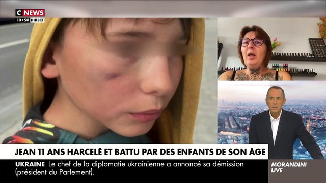 La mère de Jean, 11 ans, harcelé et battu par des enfants de son âge dans une colonie de vacances, témoigne dans Morandini Live : S'il ne s'était pas défendu, ils l'auraient violé - Regardez