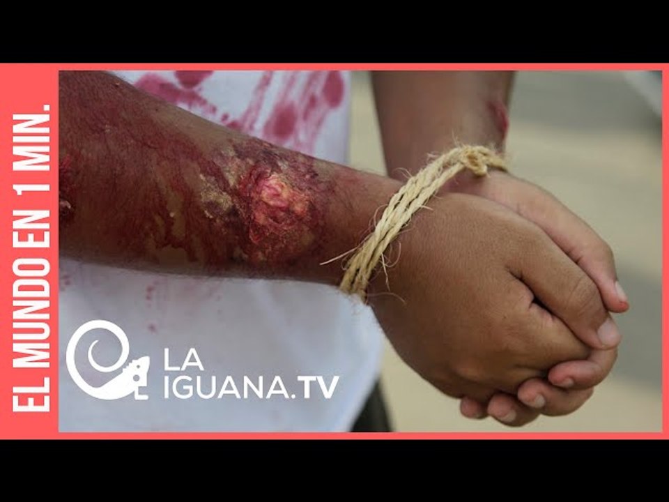 Asesinatos y abusos sexuales a mujeres: Siguen las violaciones de Derechos Humanos en Colombia