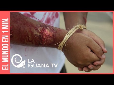 Asesinatos y abusos sexuales a mujeres: Siguen las violaciones de Derechos Humanos en Colombia