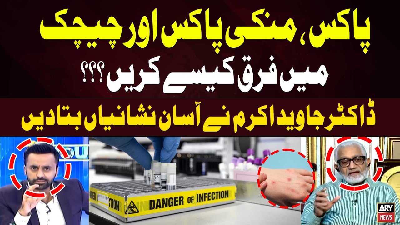 Symptoms of Monkeypox , Chickenpox and Smallpox | How Is It Different From an other? | Explained