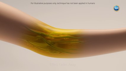 Logran volver transparente la piel para observar el organismo.