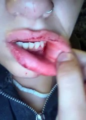 Heridas provocadas a una joven vallisoletana tras una agresión homófoba