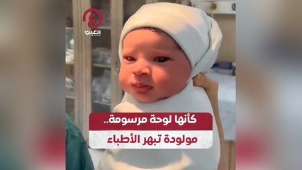 كأنها لوحة مرسومة.. مولودة تبهر الأطباء