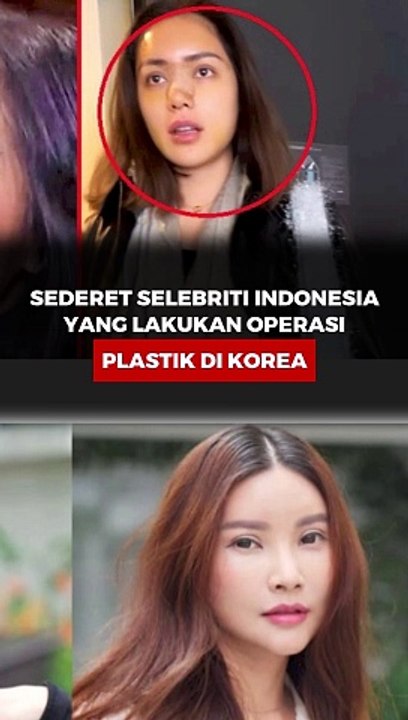 Sederet Selebriti Indonesia yang Lakukan Operasi Plastik di Korea
