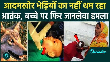Bahraich Bhedia Attack: देर रात भेड़िए का एक बच्चे पर फिर जानलेवा हमला | UP News | वनइंडिया हिंदी