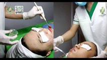 Bầu có peel da được không? Giải đáp thắc mắc cho mẹ bầu