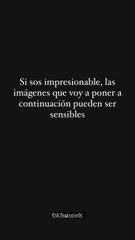 Cinthia Fernandez fue operada de urgencia (imágenes sensibles)