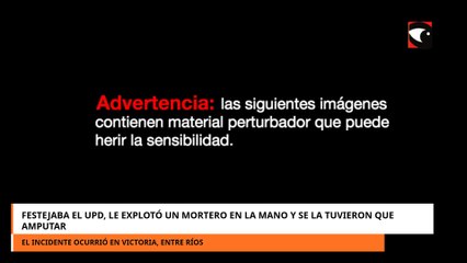 Festejaba el UPD, le explotó un mortero en la mano y se la tuvieron que amputar