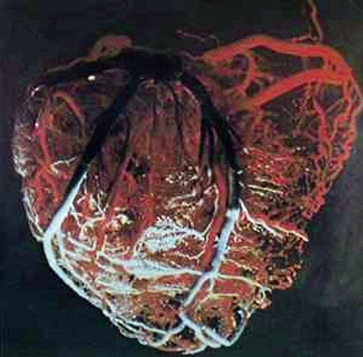 Aorta – Aorta : Psychedelic Rock, Prog Rock, Symphonic RockYear:1969