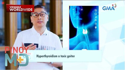 Matinding pagpapawis, mabilis na tibok ng puso, at pag-ubo ng dugo, ano ang sanhi? | Pinoy MD