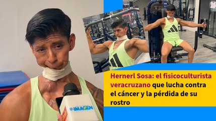 Hernerl Sosa: el fisicoculturista veracruzano que lucha contra el cáncer y la pérdida de su rostro