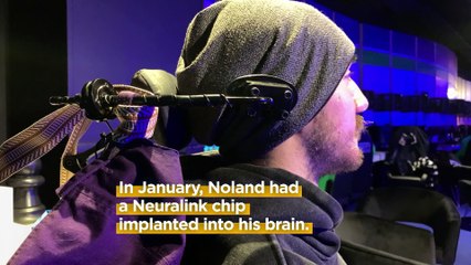 ‘People think it's like the Matrix’: Neuralink’s first patient on having a brain chip