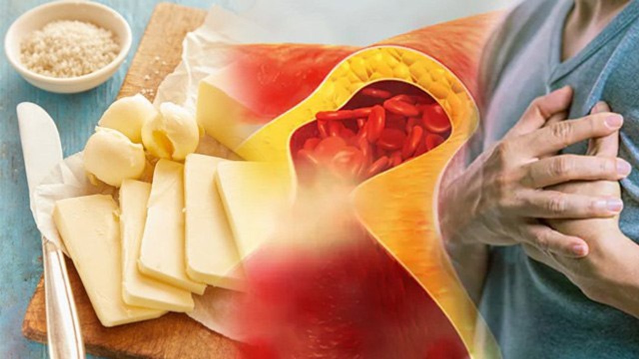 हाई कोलेस्ट्रॉल में मक्खन खाना चाहिए या नहीं | High Cholesterol Me Butter Khana Chahiye | Boldsky
