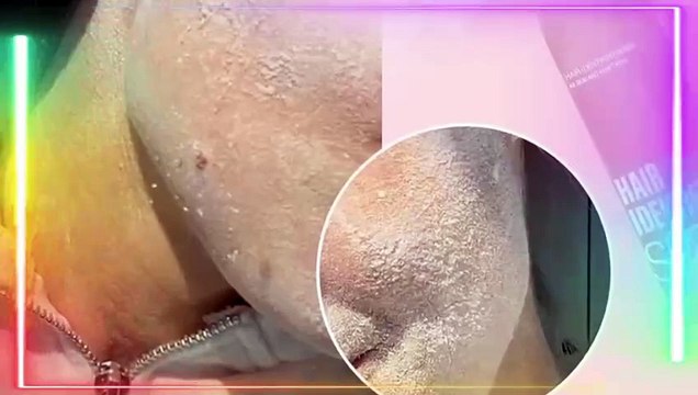 Hair Identifier Spray for Face Shaving，Skin Body Hair Identifying Spray，Used to remove excess hair from the skin, suitable for all skin types