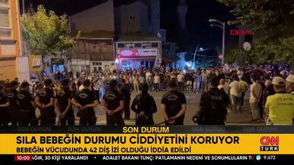 Sıla bebek olayında kan donduran yeni detay: 42 diş izi! | Video Haber