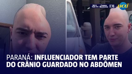 Influenciador tem parte do crânio guardada no abdômen e viraliza nas redes