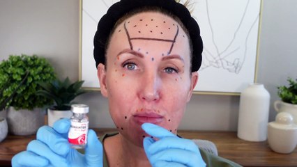 Full Face of Dehantox - Education & Tutorial #botox