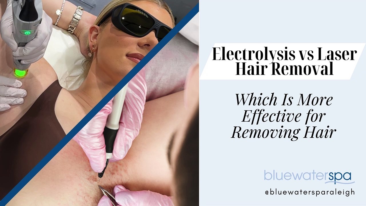 Electrolysis vs. Laser Hair Removal