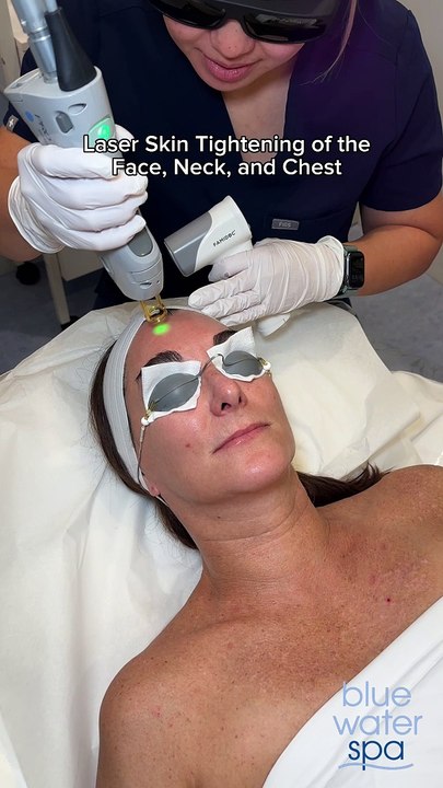 Laser Skin Tightening